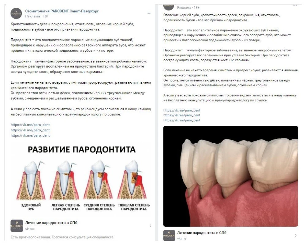 Рекламные креативы по пародонтии